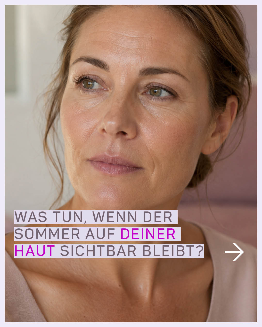 Was tun, wenn der Sommer auf Deiner Haut sichtbar bleibt?